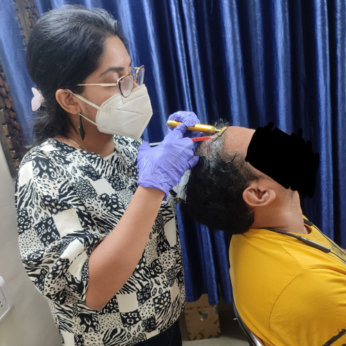 PRP hair treatment PRP Hair Treatment