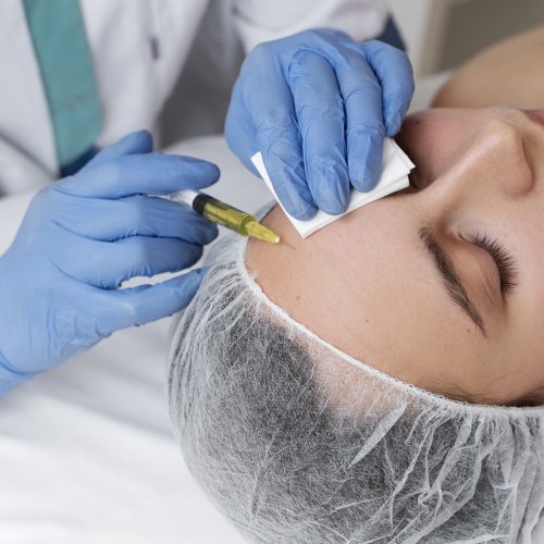 woman-getting-face-prp-treatment-high-angle PRP facial treatment